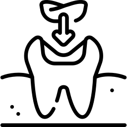 ونیر کامپوزیت