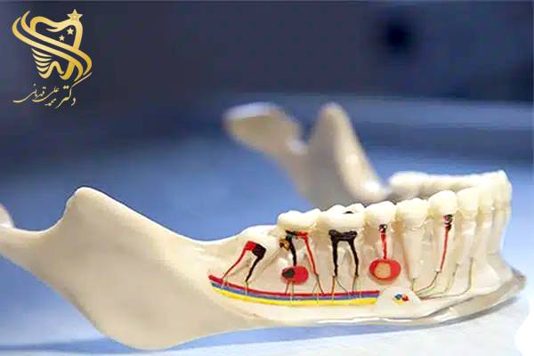 ریشه دندان دکترقهرمانی