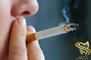 کشیدن سیگار بعد از عصب کشی دندان