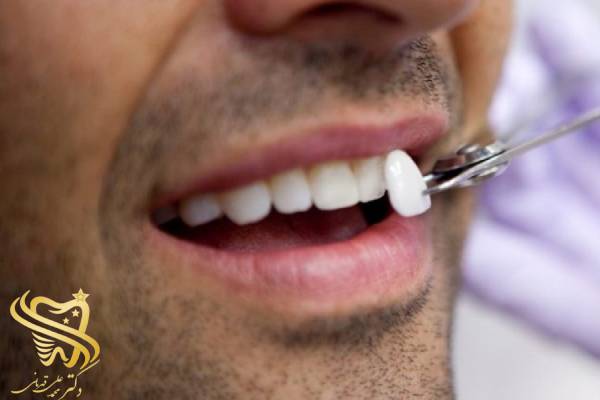 دندان دکتر قهرمانی 2 1