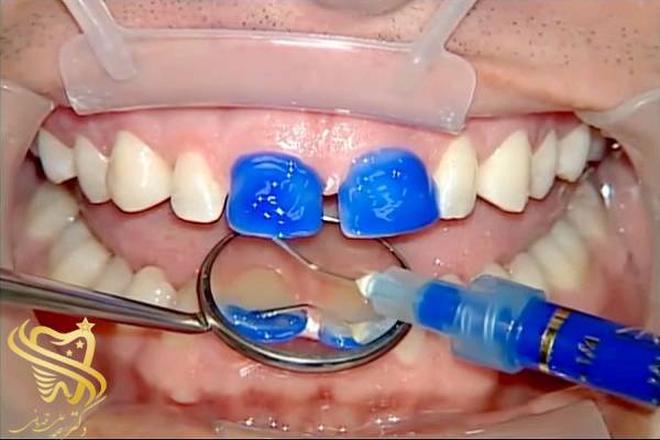 دندان دکتر قهرمانی 3