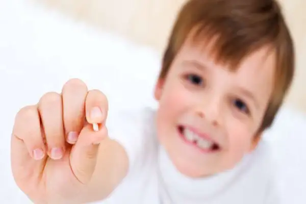 از چند سالگی دندان های شیری کودک می افتند؟