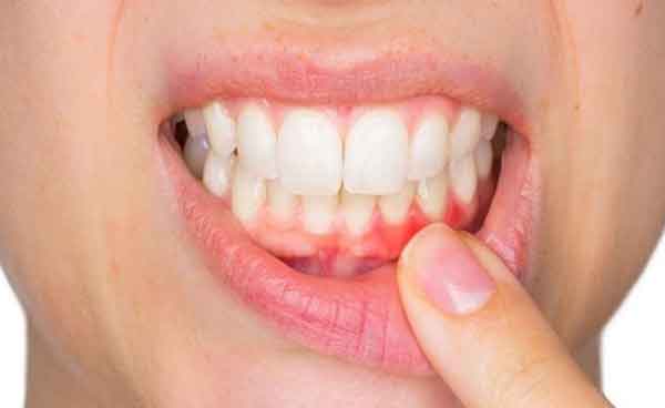 اگر عفونت دندان درمان نشود چه میشود